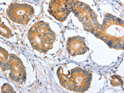 BLNK Antibody (PACO19352)