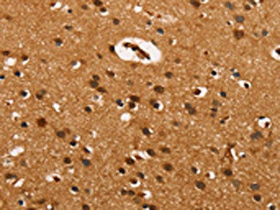 CABLES2 Antibody (PACO19370)