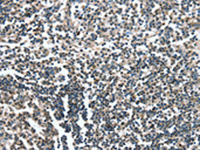 CAMTA1 Antibody (PACO19384)
