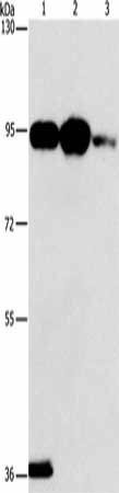 PLA2G4B Antibody (PACO19501)