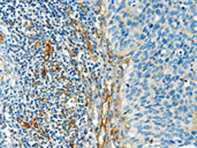 DIO2 Antibody (PACO19573)
