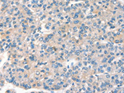 KCNB1 Antibody (PACO19583)