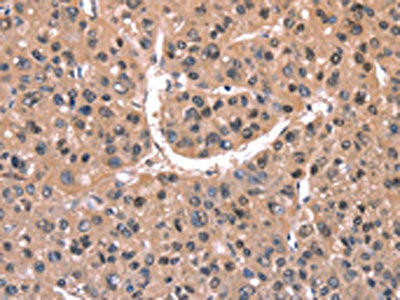 EXTL1 Antibody (PACO19638)