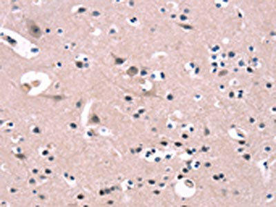 FGF16 Antibody (PACO19656)