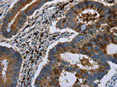 FMN2 Antibody (PACO19672)