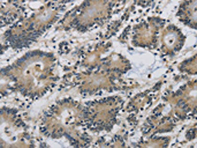 IMPAD1 Antibody (PACO19838)
