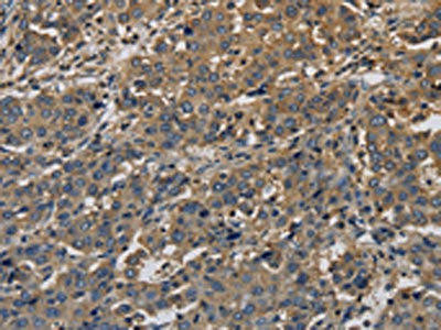 KCNA7 Antibody (PACO19875)