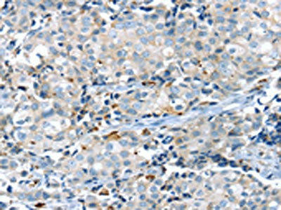 KCNG3 Antibody (PACO19882)