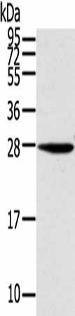 KCNMB3 Antibody (PACO19889)
