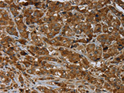 ARHGEF12 Antibody (PACO19922)