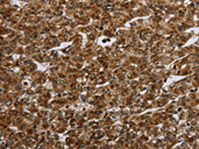 CERS1 Antibody (PACO19924)