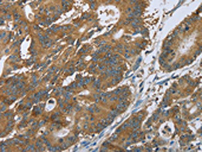 CERS4 Antibody (PACO19927)