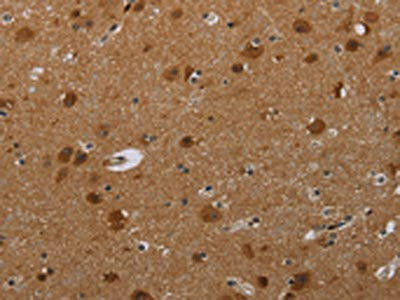 MIG7 Antibody (PACO20021)