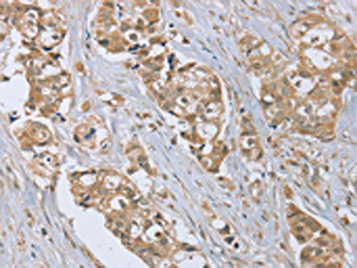 RAB6C Antibody (PACO20303)