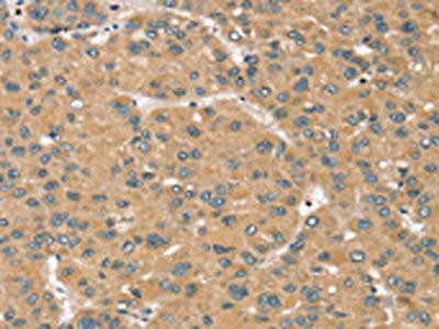 RBM38 Antibody (PACO20326)