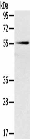 SLC16A10 Antibody (PACO20477)