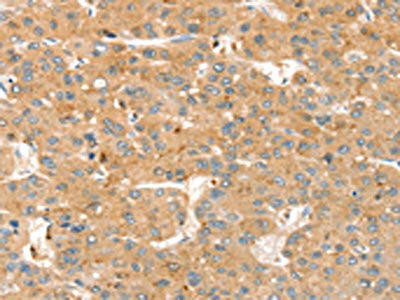 SMOC2 Antibody (PACO20559)