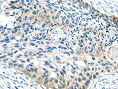 SPDL1 Antibody (PACO20599)