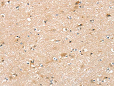 ZFP36L2 Antibody (PACO20705)