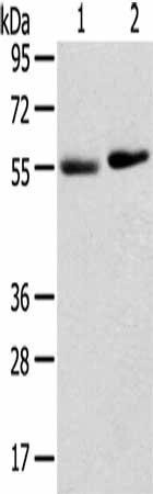 TMPRSS11F Antibody (PACO20717)