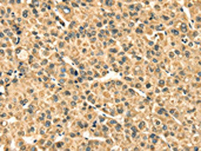 TMPRSS3 Antibody (PACO20719)