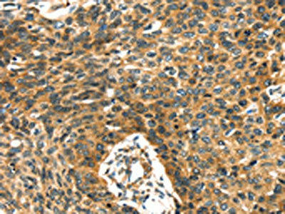 PRSS50 Antibody (PACO20776)