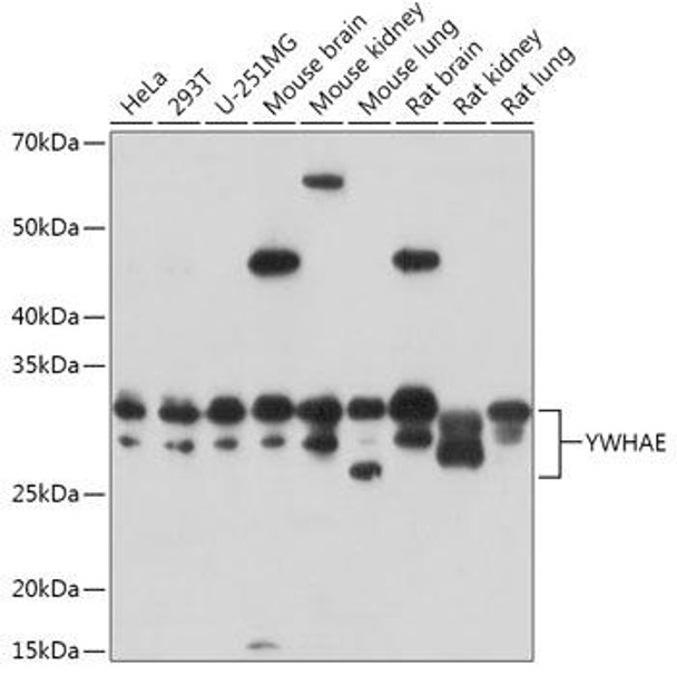 Anti-YWHAE Antibody (CAB1058)