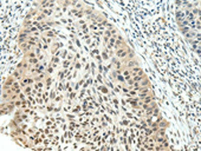 NSD1 Antibody (PACO20828)