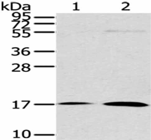 UTS2B Antibody (PACO20843)