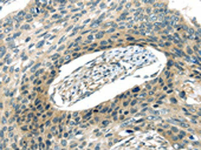 VAMP2 Antibody (PACO20849)