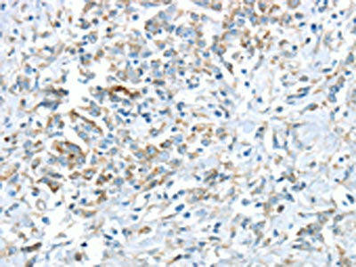 VWCE Antibody (PACO20868)
