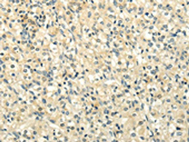 BRWD1 Antibody (PACO20872)