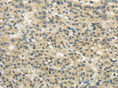 WDR91 Antibody (PACO20874)