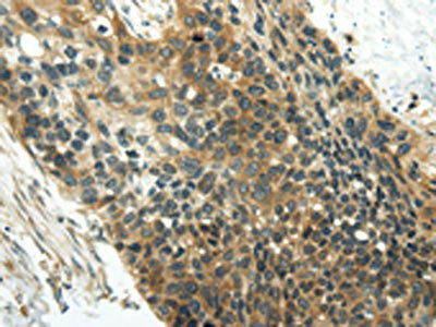 WISP1 Antibody (PACO20882)