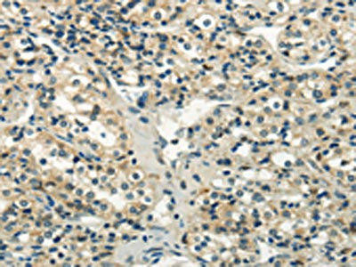 WNK2 Antibody (PACO20886)