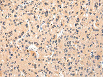 IKZF4 Antibody (PACO20959)