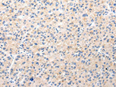 BSN Antibody (PACO20962)