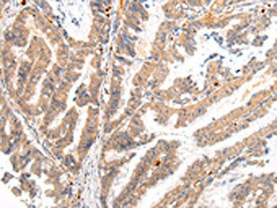 BSN Antibody (PACO20963)