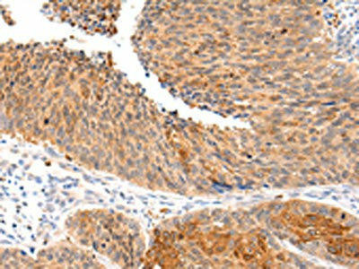 ZNF420 Antibody (PACO20964)