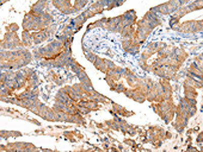 MUC1 Antibody (PACO20981)