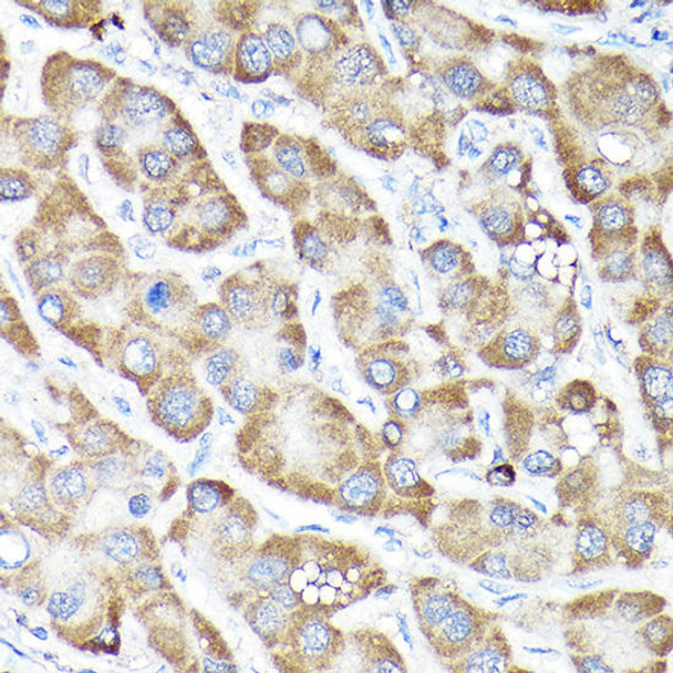 Anti-NRF2 Antibody (CAB11159)