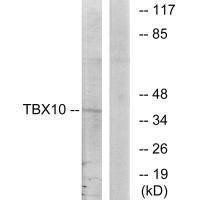 TBX10 Antibody (PACO21698)
