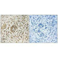 CIB2 Antibody (PACO21704)