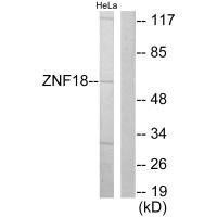 ZNF18 Antibody (PACO21736)