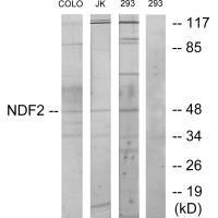 NEUROD2 Antibody (PACO21862)