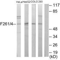 PFKFB1/PFKFB4 Antibody (PACO21867)