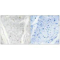ALPK2 Antibody (PACO21888)