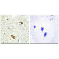 PLXDC1 Antibody (PACO21891)