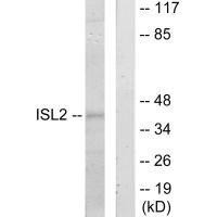 ISL2 Antibody (PACO21925)