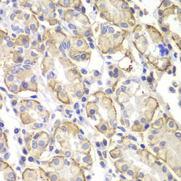 Anti-Lyn Antibody (CAB11385)